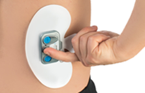 ActiPatch® Compared to IcyHot® Smart Relief™ TENS (Transcutaneous